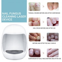 South Moon Nail Fungal Cleaning Laser Relief Device, Gray Nail Bad Nail Thickening Soft Nail Bright Nail Care Instrument