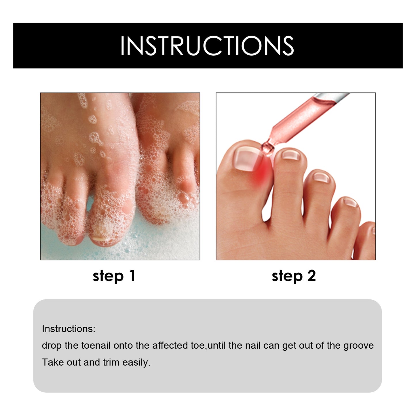 South Moon Toenail Repair Serum 30ml Moisturizing Repair Cleansing Foot Nail Brightening Nail Care Oil