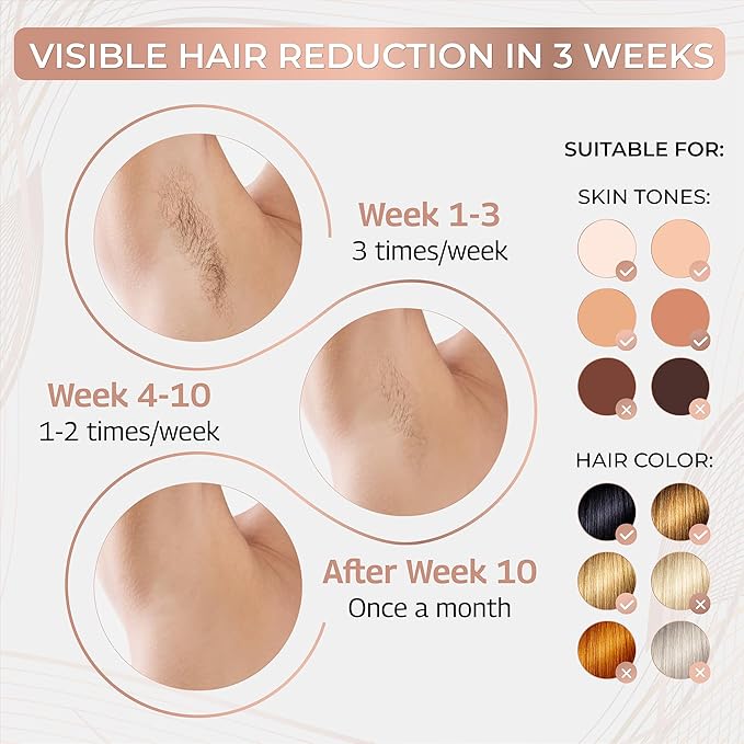 Intense Pulsed Light (IPL) System