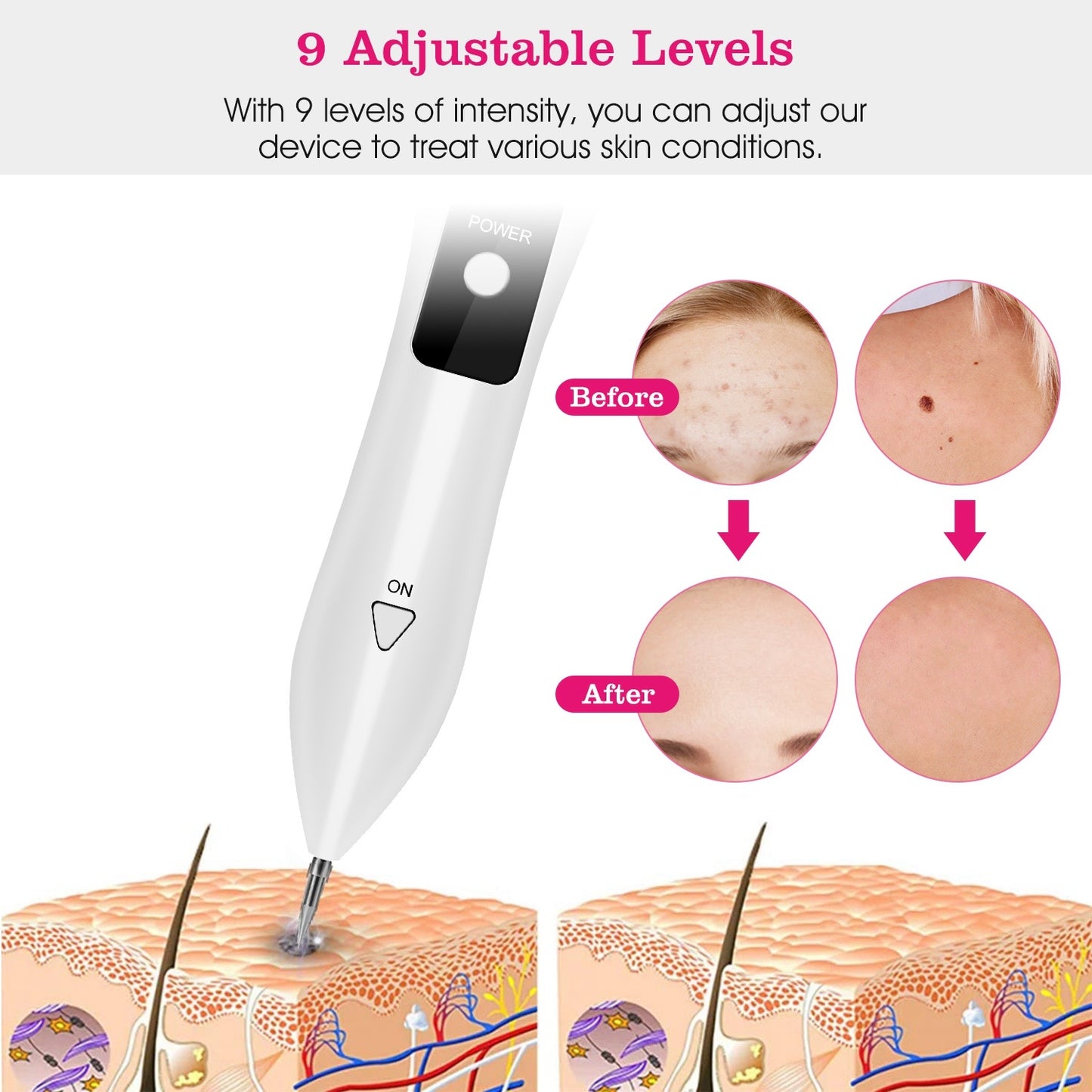2 PCS Skin Rash Repair Kit
