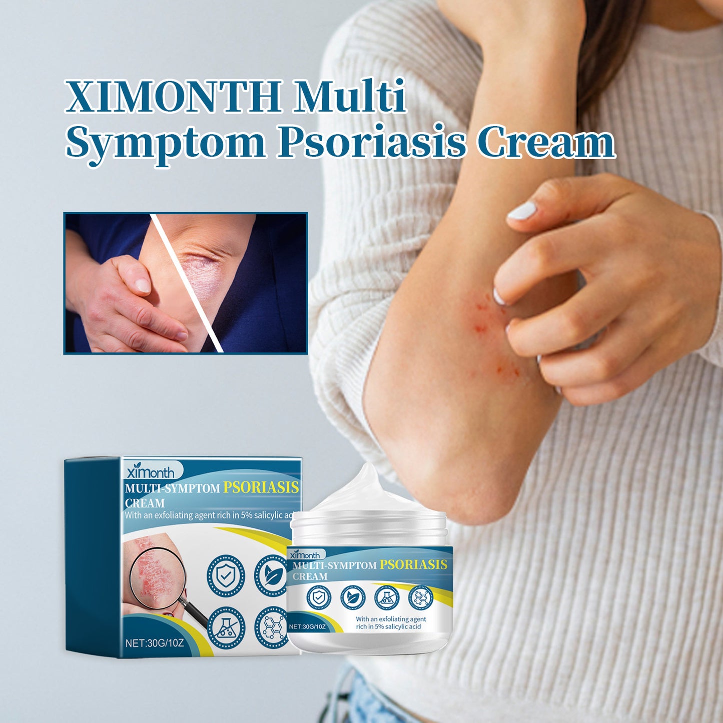 Ximonth Psoriasis Treatment Cream Repair Hand, Foot And Body Moss Redness And Itchy Skin Topical Treatment Cream