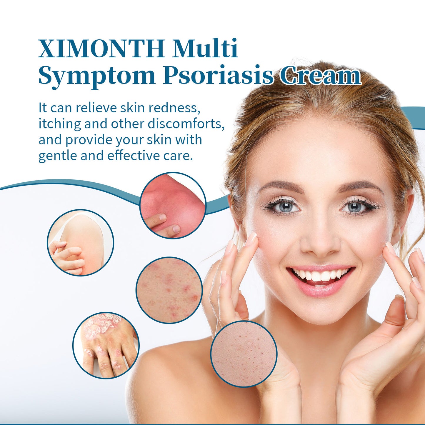 Ximonth Psoriasis Treatment Cream Repair Hand, Foot And Body Moss Redness And Itchy Skin Topical Treatment Cream