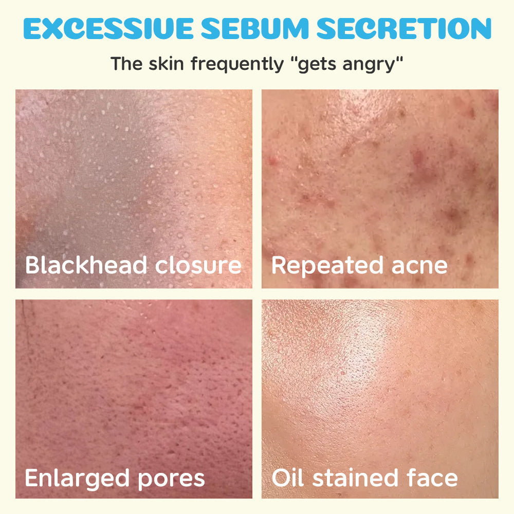 BABY OIL CONTRO SERUM