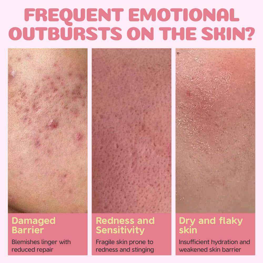 BABY SENSITIVE SERUM