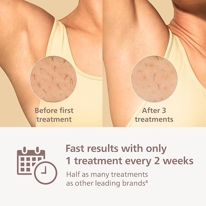 Philips Lumea 9000 Series IPL Hair Removal Device, Visible Permanent Laser Hair Reduction Done at Home, for Women & Men, SenseIQ Technology, 4 Attachments for Body, Face, Bikini & Underarms, BRI984/03