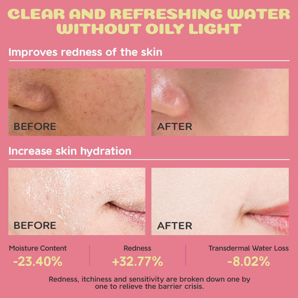 BABY SENSITIVE SERUM