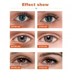 EELHOE A Alcohol Eye Cream, Firming Eye Area Improving Dark Circles And Bags Moisturizing Anti-wrinkle Cream