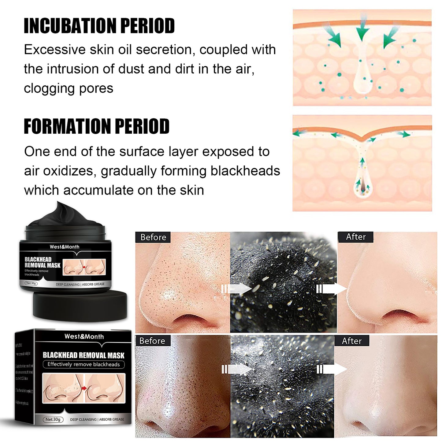 West&Month Blackhead Removal Mask, Peel Off Remove Blackhead Activated Carbon Cleansing Face Mask